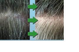 Dandruff active receives certification