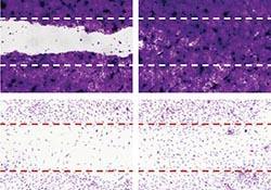 Skin regeneration – new research promises much