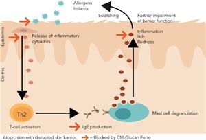 CM-Glucan Forte to rebalance the skin