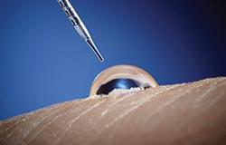 Skin resurfacing action