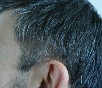 Smart bead tackles grey and white hairs