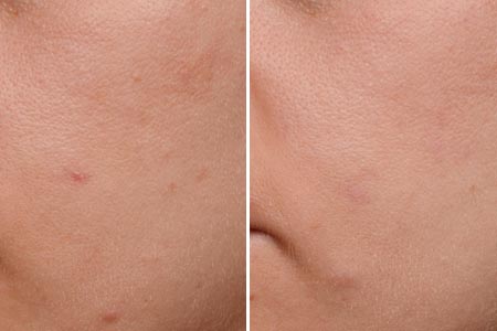 Ingredient aids skin’s natural glow