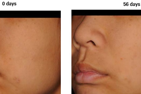 Test shows skin tone benefits