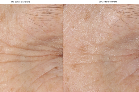 Natural anti-ageing skin care active launch