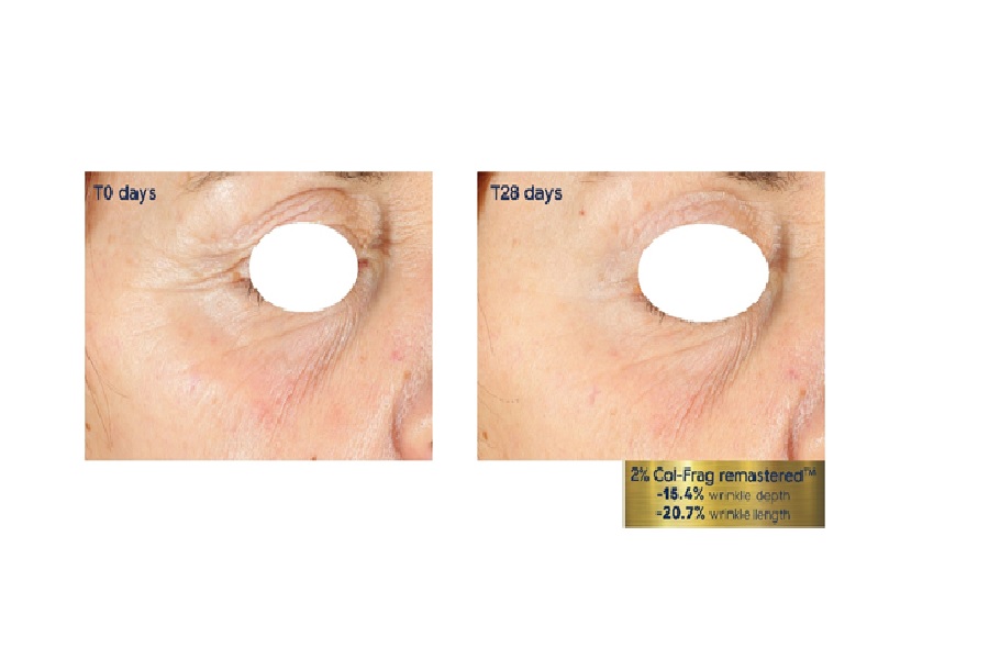 Welcome to a new collagen era