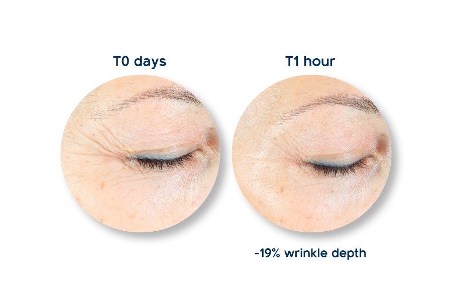 LipoTrue launches skin stress-combatting Telessence concept